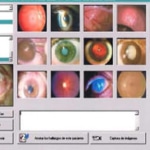 Endovista , Software Oftalmico para captura de imagenes y control de pacientes-0