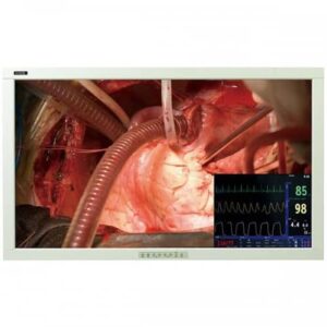 Pantalla de 42" Grado Medico para Cirugia y Microcirugia LCD alta calidad HD-0