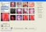 SINAPSIS COLPOS 2015 software de captura de imagenes y video Ginecologico , maneja pacientes tambien-1295