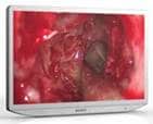 LMD2765MD Sony 27″ Medical Monitor Analogo & Digital HD ntsc para cirugia de minima invacion y quirofano -2011