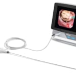 PU3022A Fully Flexible Video Single Use Ureteroscope PUSEN  nuevo modelo invertido-3415